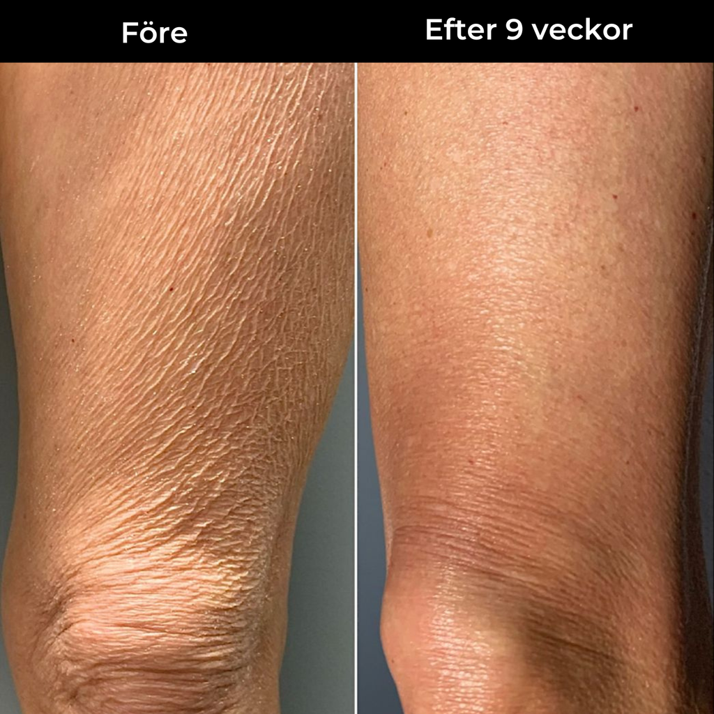 Skin Theory Retinol Kropslotion