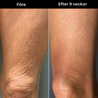 Skin Theory Retinol Kropslotion