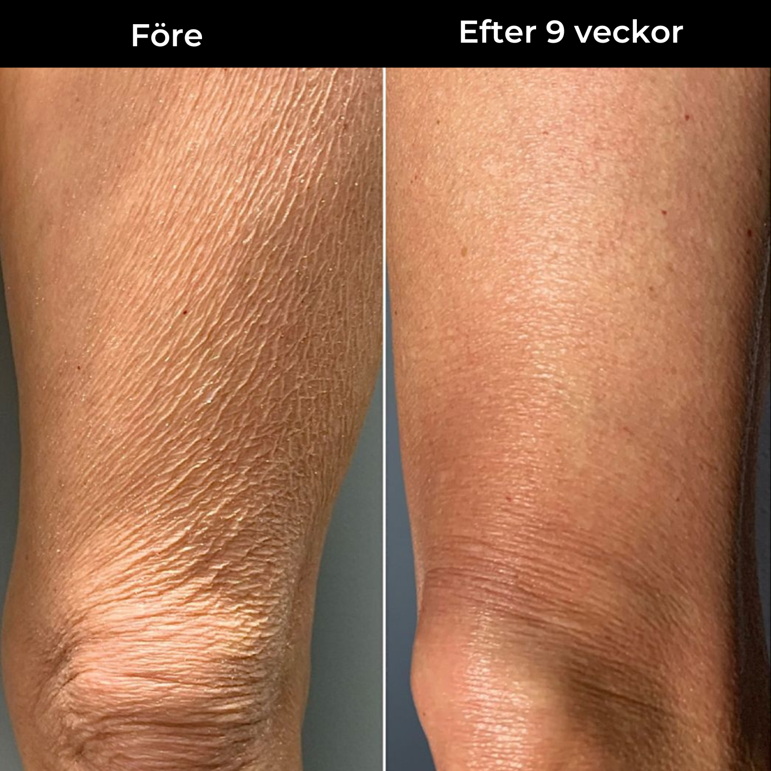 Skin Theory Retinol Kropslotion