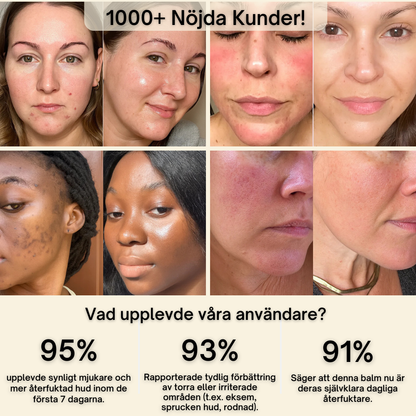 Organic Tallow Honey Balm - Återfukta & lugna din hud på det naturliga sättet