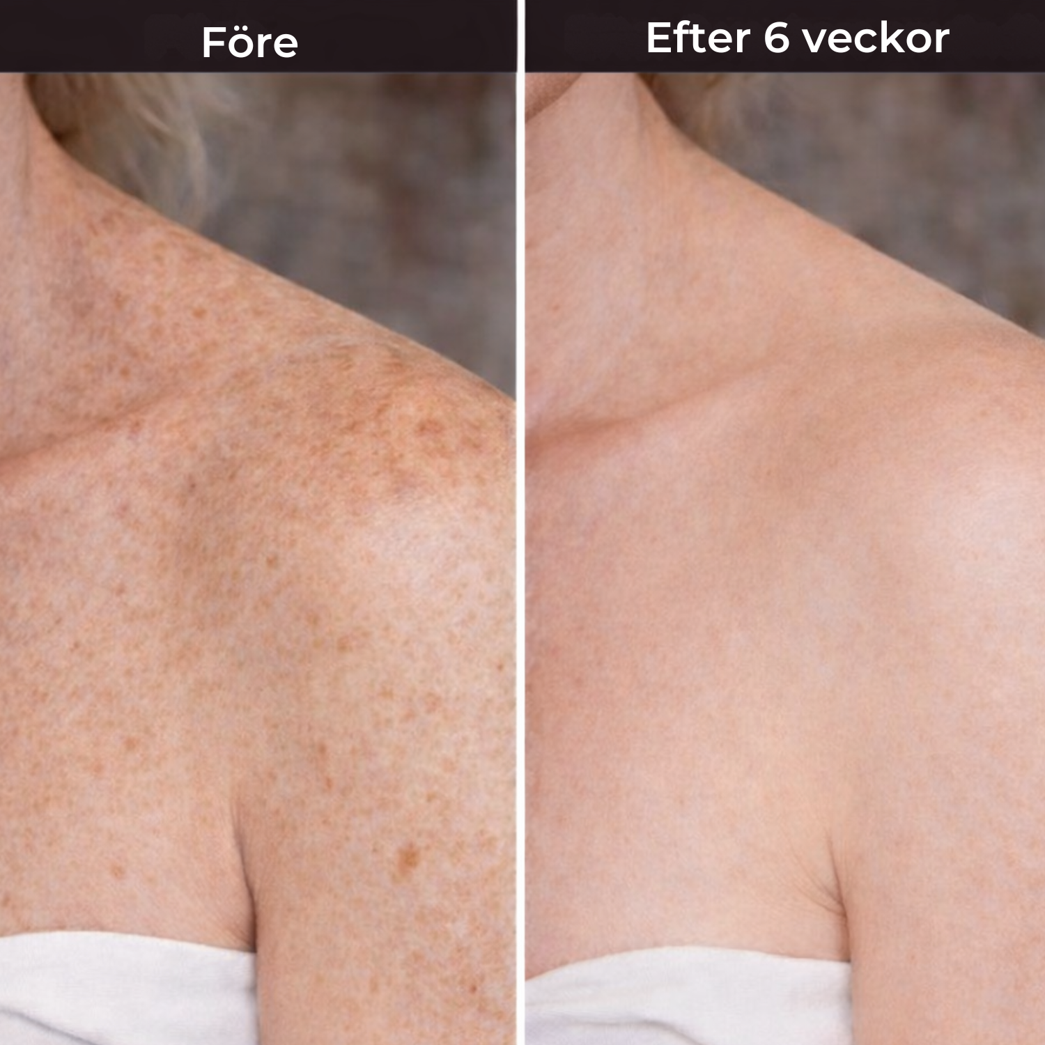 Skin Theory Retinol Kropslotion